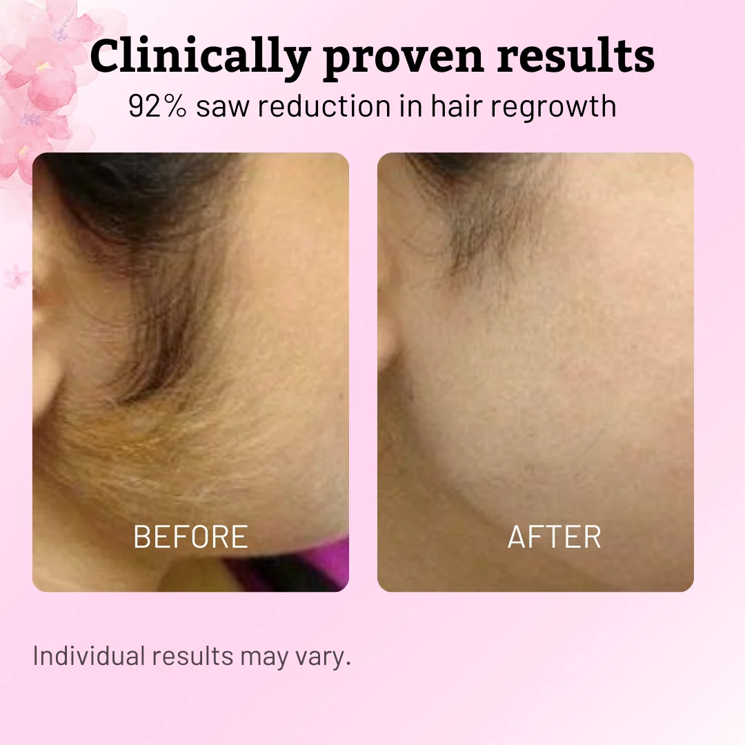 Facial-hair comparison supplied for Caramela Beauty; individual results vary