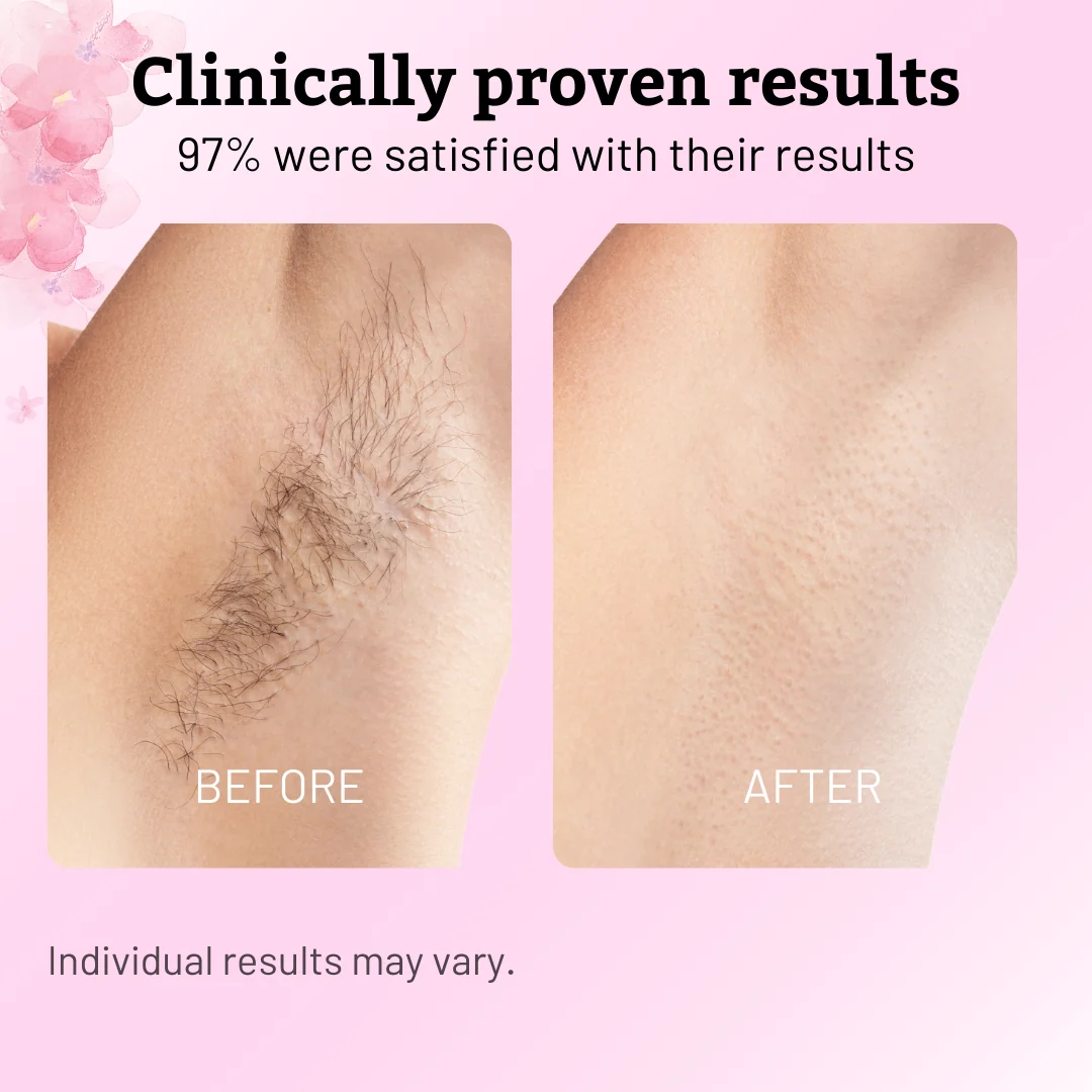 Underarm comparison supplied for Caramela Beauty; individual results vary